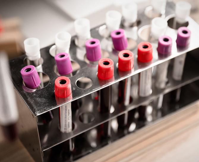10 Common Laboratory Problems and Solutions: Lab Safety Topics