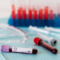 Blood Bank Temperature Monitoring